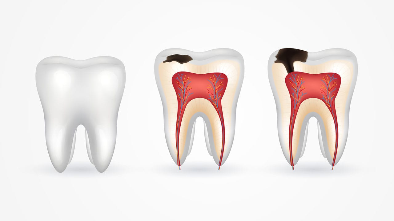 Dentist Mt Olive